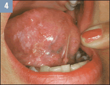 can horses eat tobacco Identification of potential biomarkers in urine and plasma after consumption of tobacco product in horses - Ishii - 2022 - Drug Testing and Analysis