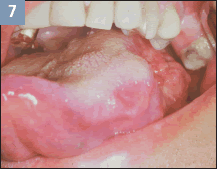3 main chemicals in tobacco Combustion in Cigarettes