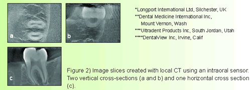 Periodontal_endoscope_figure2